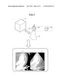 IMAGE PROCESSING SYSTEM, X-RAY DIAGNOSTIC APPARATUS, AND IMAGE PROCESSING     METHOD diagram and image