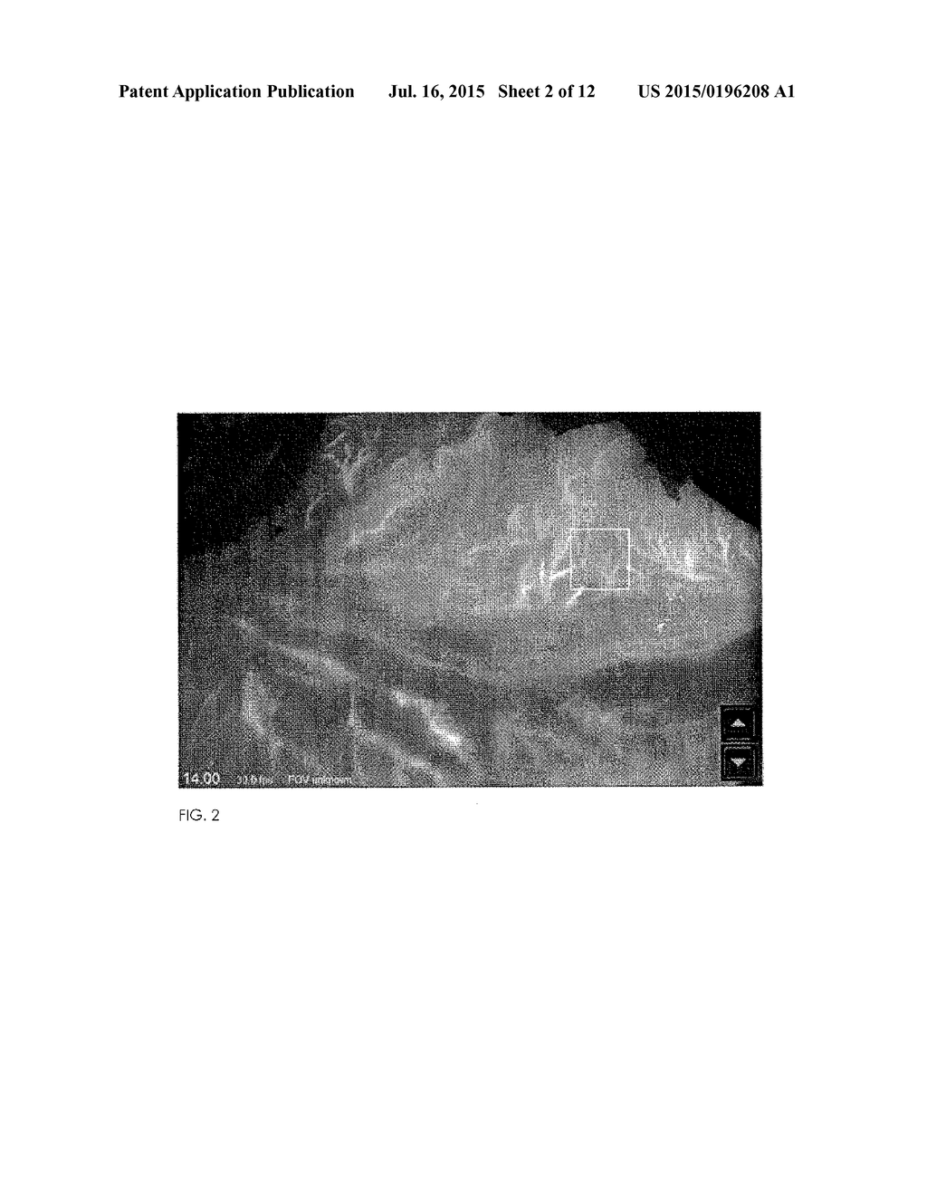 METHOD FOR EVALUATING BLUSH IN MYOCARDIAL TISSUE - diagram, schematic, and image 03