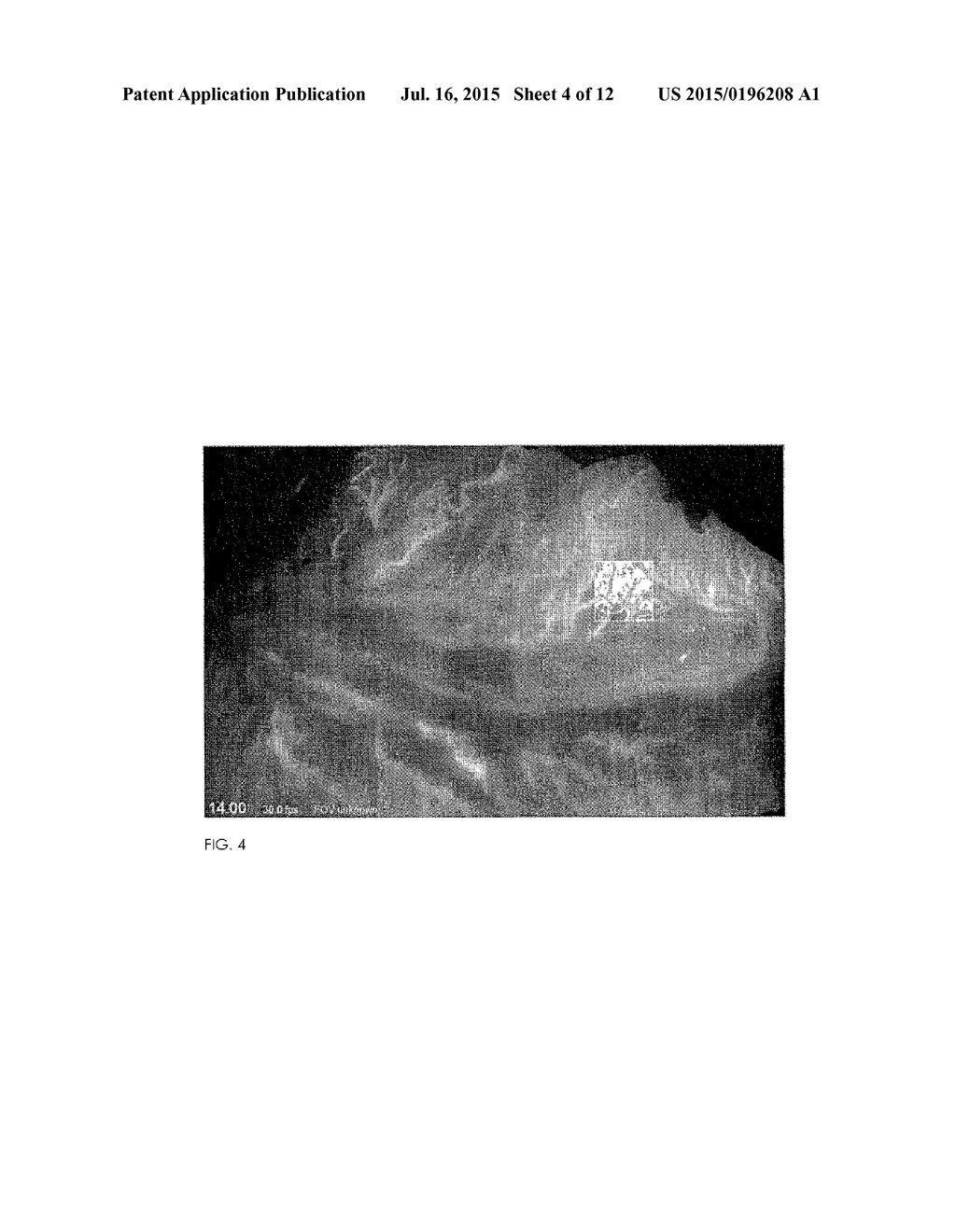 METHOD FOR EVALUATING BLUSH IN MYOCARDIAL TISSUE - diagram, schematic, and image 05