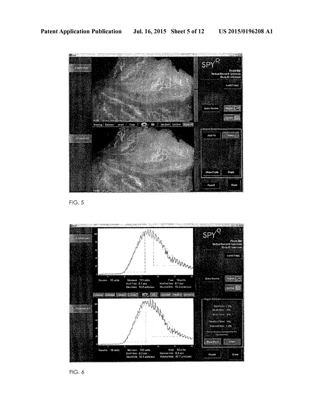 METHOD FOR EVALUATING BLUSH IN MYOCARDIAL TISSUE - diagram, schematic, and image 06