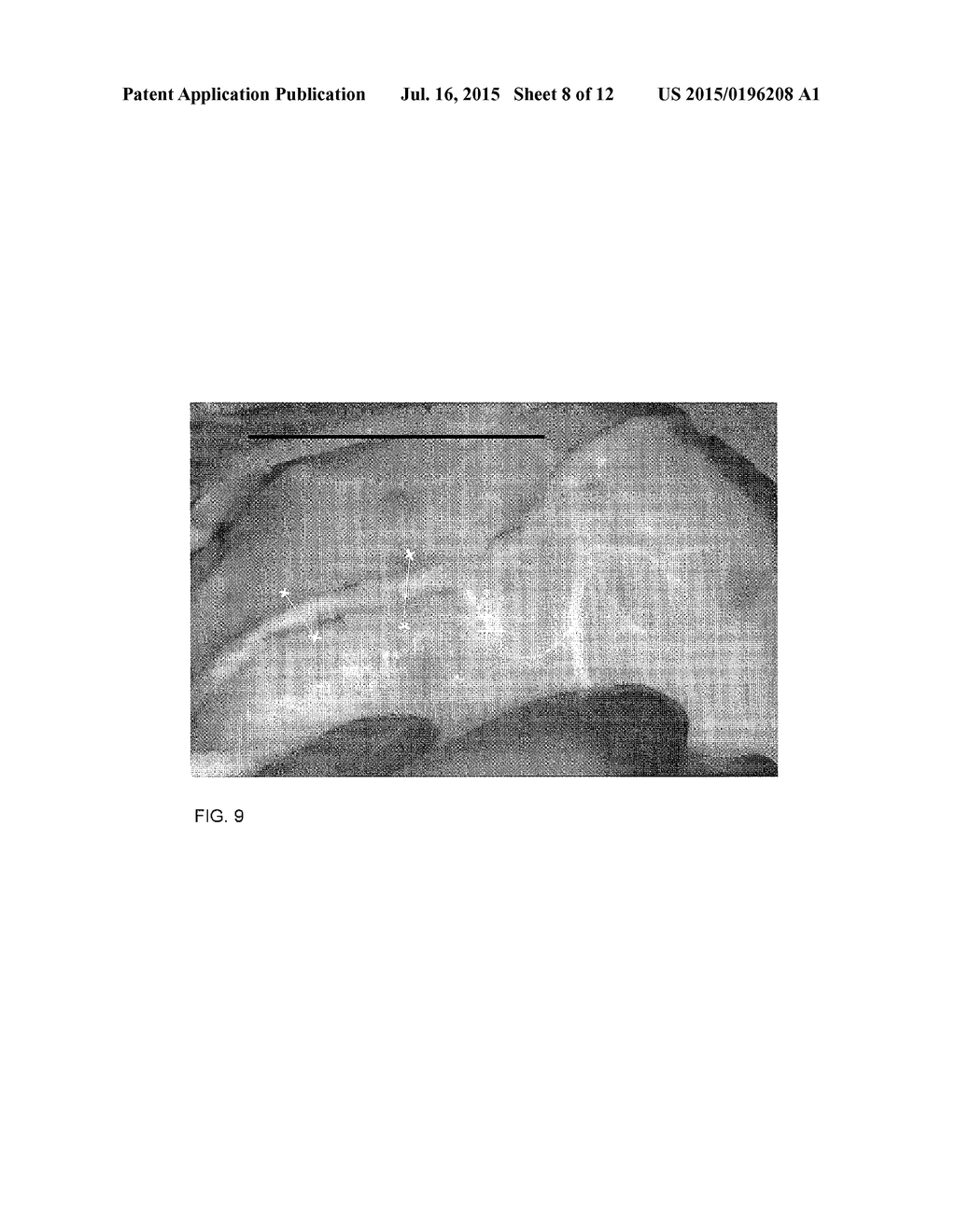 METHOD FOR EVALUATING BLUSH IN MYOCARDIAL TISSUE - diagram, schematic, and image 09