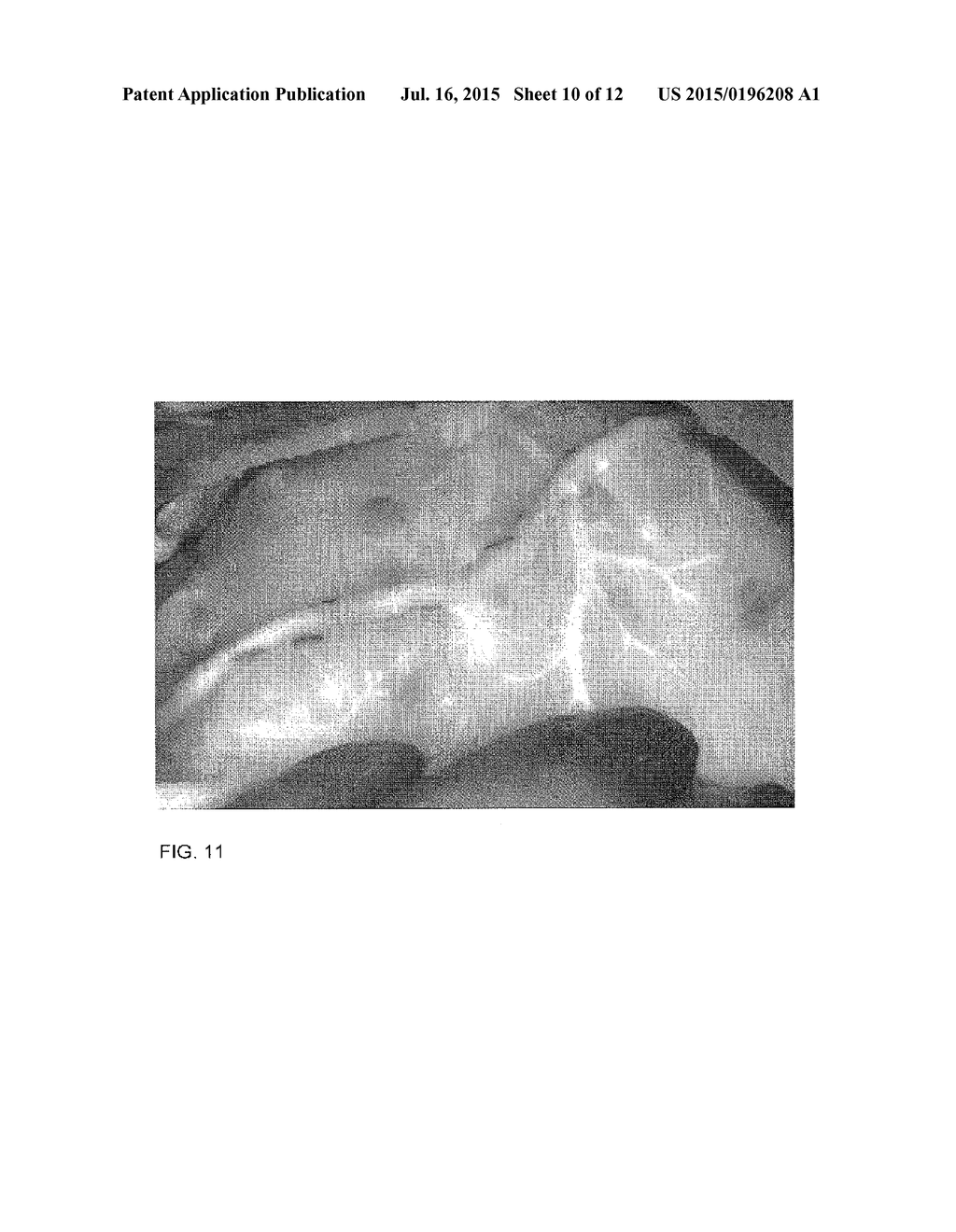 METHOD FOR EVALUATING BLUSH IN MYOCARDIAL TISSUE - diagram, schematic, and image 11