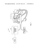 MEDICAL DEVICES FOR MAPPING CARDIAC TISSUE diagram and image