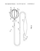 MEDICAL DEVICES FOR MAPPING CARDIAC TISSUE diagram and image