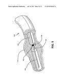 DETECTING ENDOLEAKS ASSOCIATED WITH ANEURYSM REPAIR diagram and image