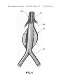 DETECTING ENDOLEAKS ASSOCIATED WITH ANEURYSM REPAIR diagram and image