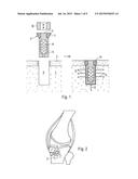 DEVICE TO BE IMPLANTED IN A HUMAN OR ANIMAL BODY FOR MATERIAL OR SIGNAL     DELIVERY OR ACQUISITION WITHIN THE BODY, AND METHOD OF IMPLANTING THE     DEVICE diagram and image