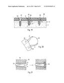 DEVICE TO BE IMPLANTED IN A HUMAN OR ANIMAL BODY FOR MATERIAL OR SIGNAL     DELIVERY OR ACQUISITION WITHIN THE BODY, AND METHOD OF IMPLANTING THE     DEVICE diagram and image