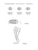 ARTERIAL DEVICE, SYSTEM AND METHOD FOR REMOVING EMBOLIC DEBRIS diagram and image