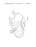 ARTERIAL DEVICE, SYSTEM AND METHOD FOR REMOVING EMBOLIC DEBRIS diagram and image