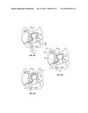 DISSECTING CANNULA AND METHODS OF USE THEREOF diagram and image