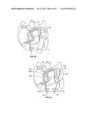 DISSECTING CANNULA AND METHODS OF USE THEREOF diagram and image