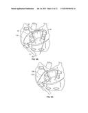 DISSECTING CANNULA AND METHODS OF USE THEREOF diagram and image