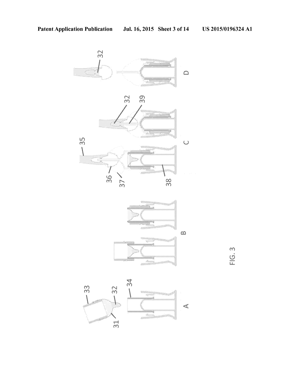 Artificial Insemination and Vaginal Insertion - diagram, schematic, and image 04