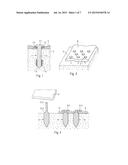 SURGICAL METHOD, KIT OF PARTS, AND IMPLANT diagram and image