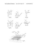 SURGICAL METHOD, KIT OF PARTS, AND IMPLANT diagram and image