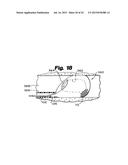 EVERTED FILTER DEVICE diagram and image