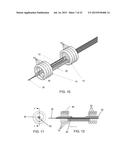 METHOD AND APPARATUS FOR REPAIRING VASCULAR ABNORMALITIES AND/OR OTHER     BODY LUMEN ABNORMALITIES USING AN ENDOLUMINAL APPROACH AND A FLOWABLE     FORMING MATERIAL diagram and image