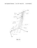 METHOD AND APPARATUS FOR REPAIRING VASCULAR ABNORMALITIES AND/OR OTHER     BODY LUMEN ABNORMALITIES USING AN ENDOLUMINAL APPROACH AND A FLOWABLE     FORMING MATERIAL diagram and image