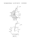 METHODS AND DEVICES FOR DEPLOYING AND RELEASING A TEMPORARY IMPLANT WITHIN     THE BODY diagram and image