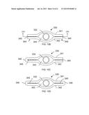 METHODS AND DEVICES FOR DEPLOYING AND RELEASING A TEMPORARY IMPLANT WITHIN     THE BODY diagram and image