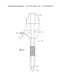 ADJUSTABLE IMPLANT AND METHOD OF USE diagram and image