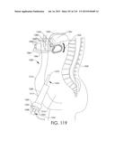 ADJUSTABLE IMPLANT AND METHOD OF USE diagram and image