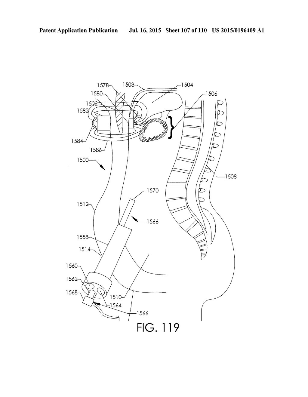 ADJUSTABLE IMPLANT AND METHOD OF USE - diagram, schematic, and image 108