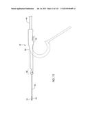 ADJUSTABLE IMPLANT AND METHOD OF USE diagram and image