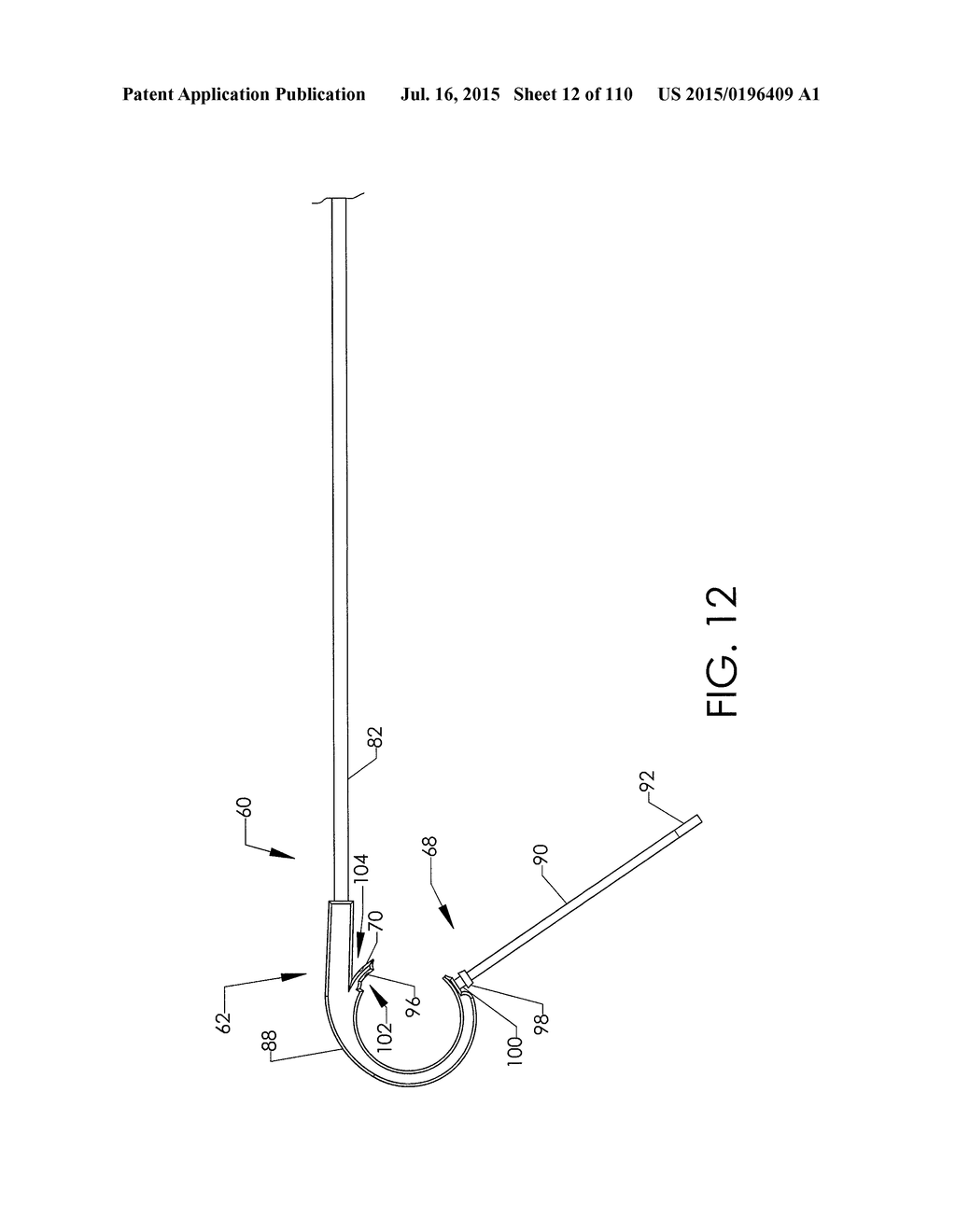 ADJUSTABLE IMPLANT AND METHOD OF USE - diagram, schematic, and image 13