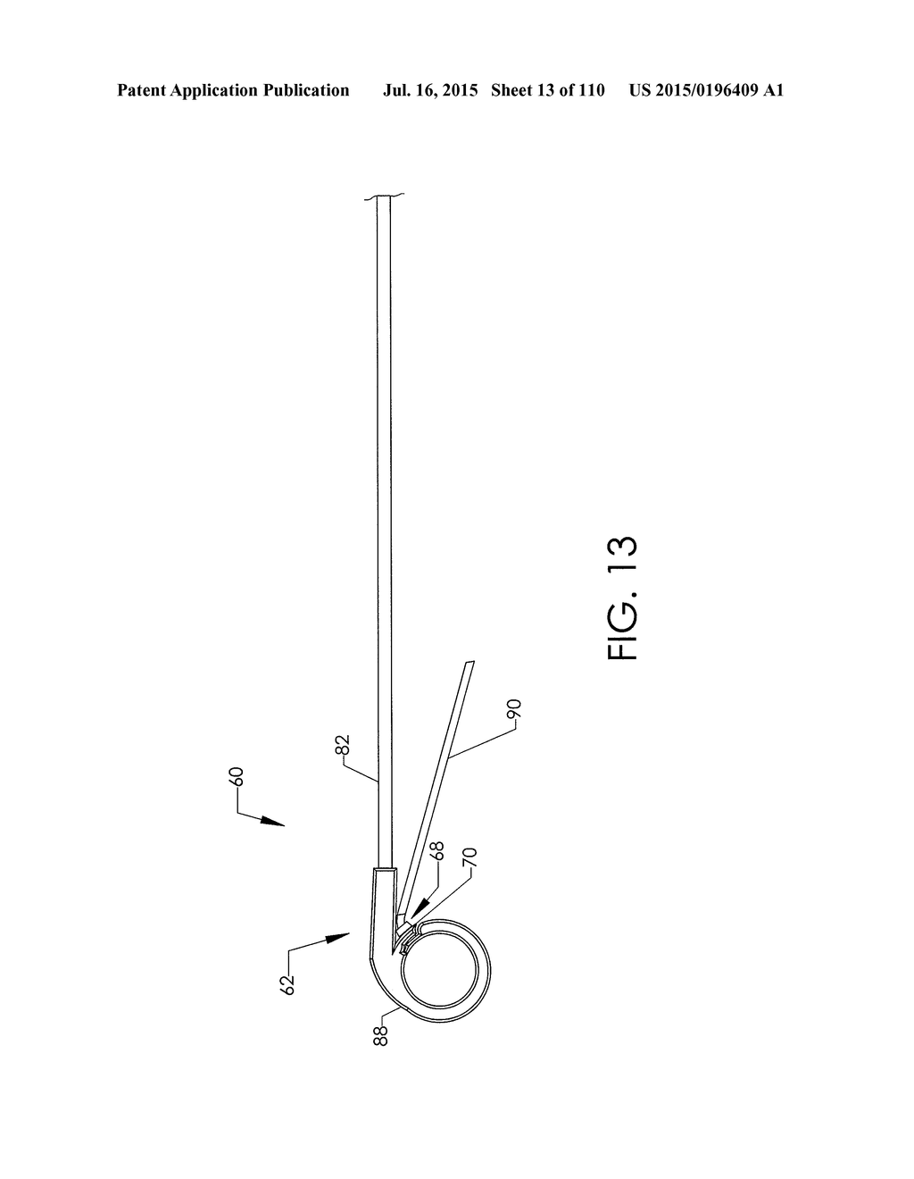 ADJUSTABLE IMPLANT AND METHOD OF USE - diagram, schematic, and image 14