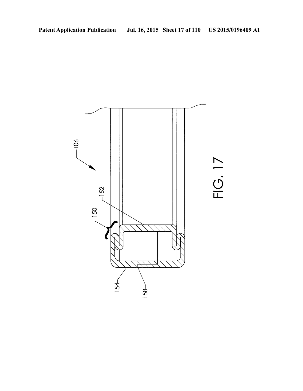 ADJUSTABLE IMPLANT AND METHOD OF USE - diagram, schematic, and image 18