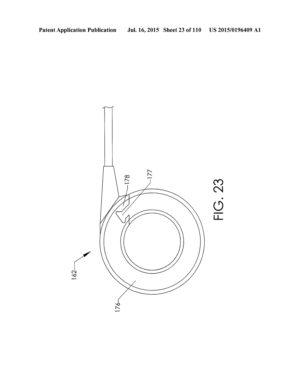 ADJUSTABLE IMPLANT AND METHOD OF USE - diagram, schematic, and image 24