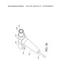 ADJUSTABLE IMPLANT AND METHOD OF USE diagram and image