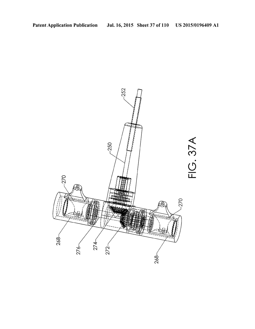 ADJUSTABLE IMPLANT AND METHOD OF USE - diagram, schematic, and image 38