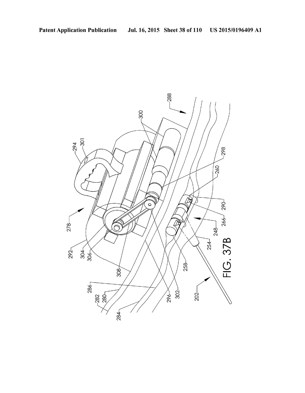 ADJUSTABLE IMPLANT AND METHOD OF USE - diagram, schematic, and image 39