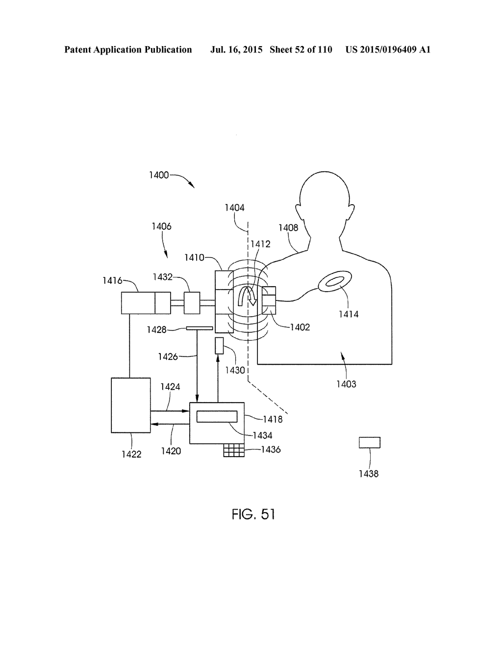 ADJUSTABLE IMPLANT AND METHOD OF USE - diagram, schematic, and image 53