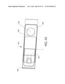 ADJUSTABLE IMPLANT AND METHOD OF USE diagram and image