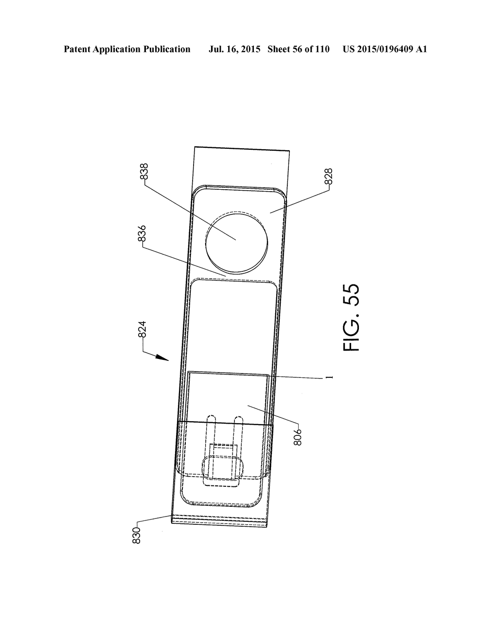 ADJUSTABLE IMPLANT AND METHOD OF USE - diagram, schematic, and image 57