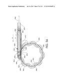 ADJUSTABLE IMPLANT AND METHOD OF USE diagram and image