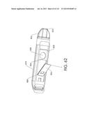 ADJUSTABLE IMPLANT AND METHOD OF USE diagram and image