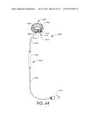 ADJUSTABLE IMPLANT AND METHOD OF USE diagram and image