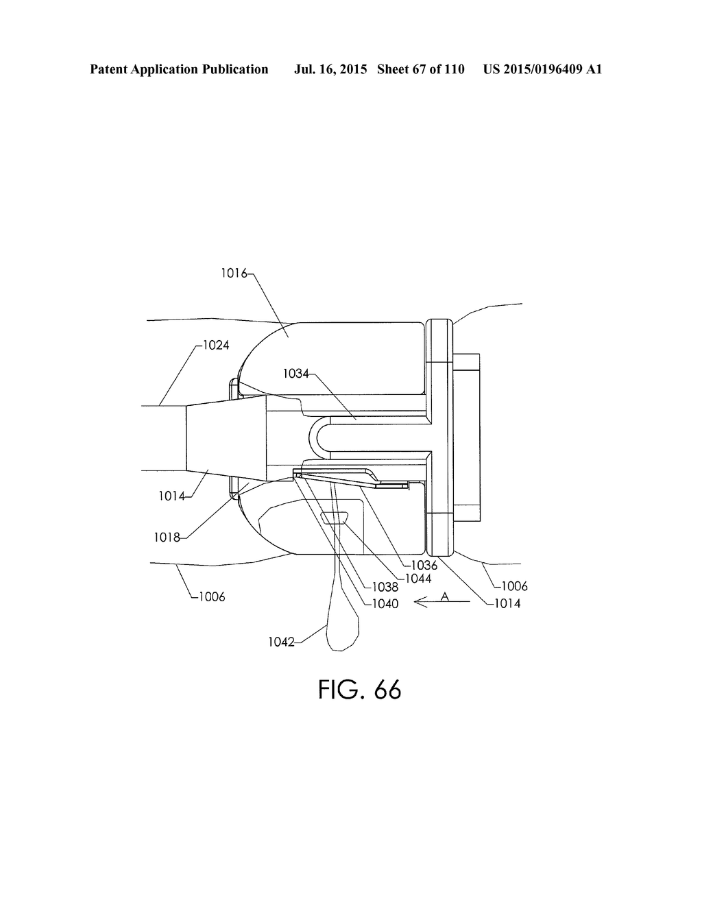 ADJUSTABLE IMPLANT AND METHOD OF USE - diagram, schematic, and image 68