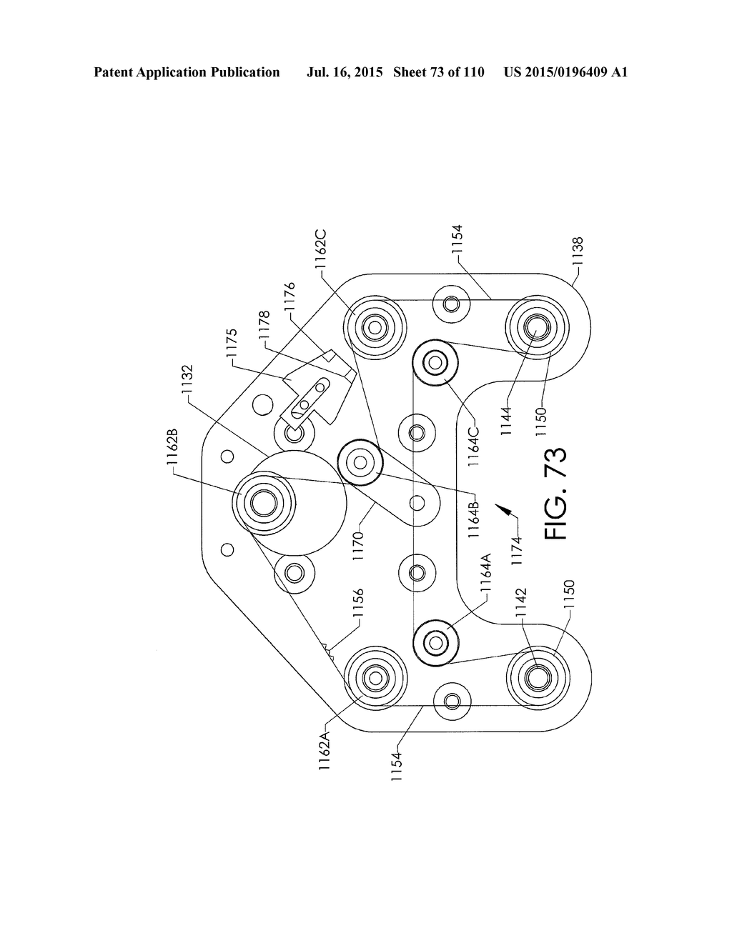 ADJUSTABLE IMPLANT AND METHOD OF USE - diagram, schematic, and image 74