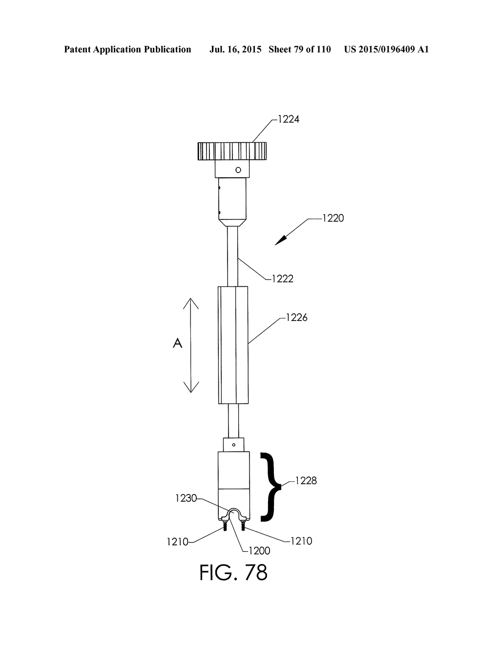 ADJUSTABLE IMPLANT AND METHOD OF USE - diagram, schematic, and image 80