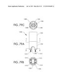 ADJUSTABLE IMPLANT AND METHOD OF USE diagram and image