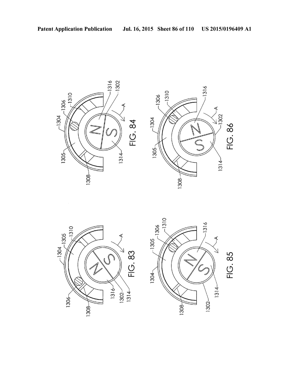 ADJUSTABLE IMPLANT AND METHOD OF USE - diagram, schematic, and image 87