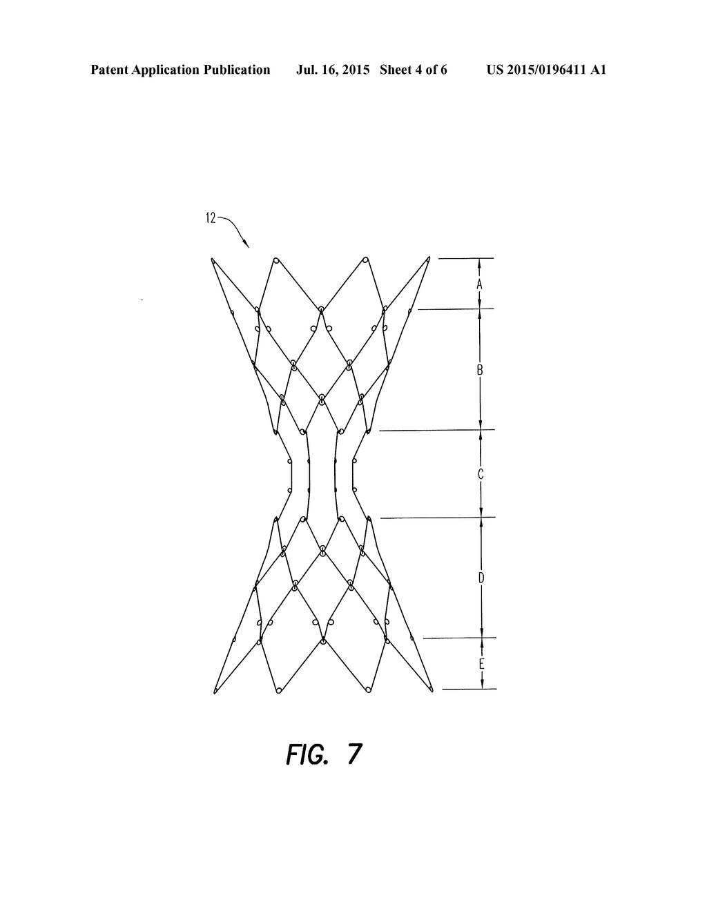 BYPASS DEVICE, SUPPORT FRAME FOR BYPASS DEVICE, AND METHOD - diagram, schematic, and image 05