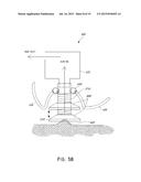 SYSTEMS AND METHODS FOR THERAPEUTIC TREATMENTS OF VARIOUS CONDITIONS OF A     FEMALE PERSON diagram and image