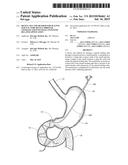 DEVICE, KIT AND METHOD FOR PLACING JEJUNAL TUBE DEVICE THROUGH STOMACH AND     INTO SMALL INTESTINE RELATED APPLICATION diagram and image